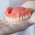 An In-Depth Look at Immediate Dentures