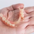 A Comprehensive Guide to Flexible Partial Dentures