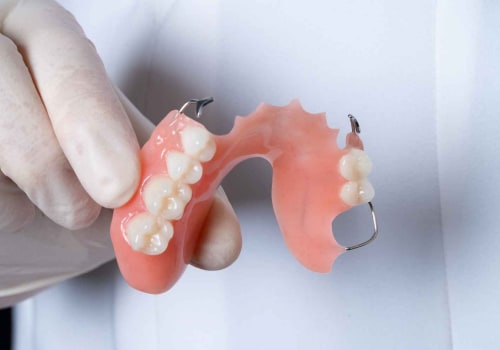 The Importance of Understanding Different Types of Dentures