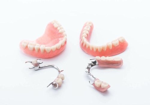 Understanding the Different Financing Options for Dentures
