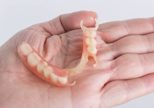 A Comprehensive Guide to Flexible Partial Dentures